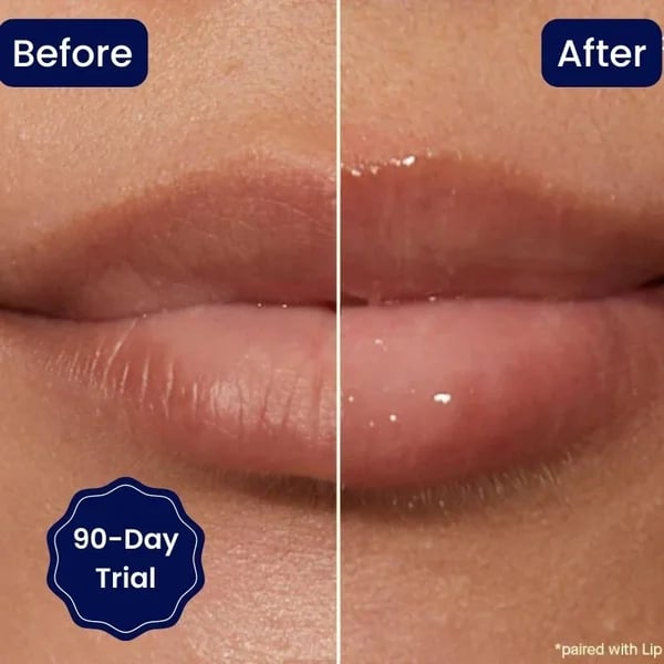šBIG SALE š„VITAMIN E LIP SERUM